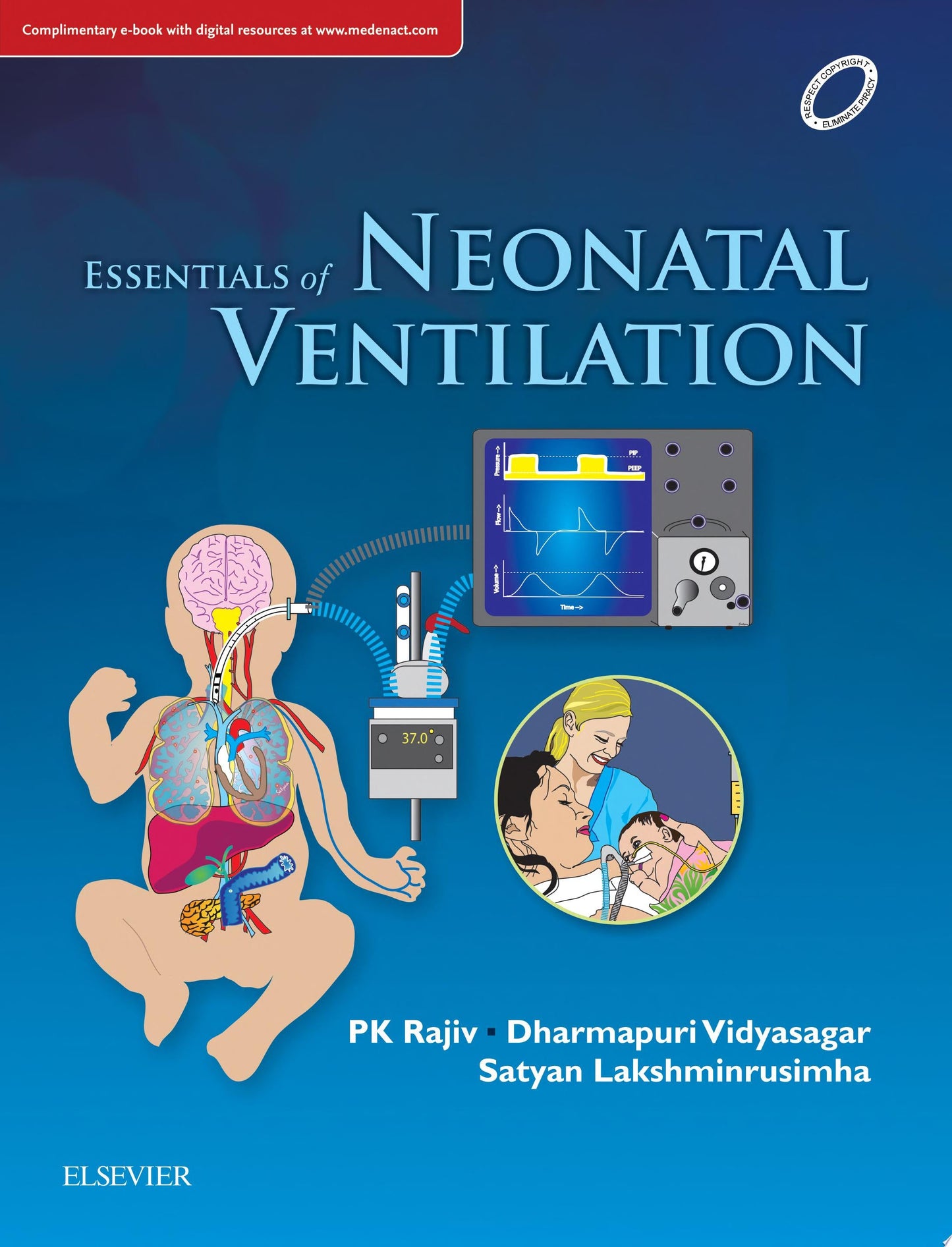 Essentials of Neonatal Ventilation