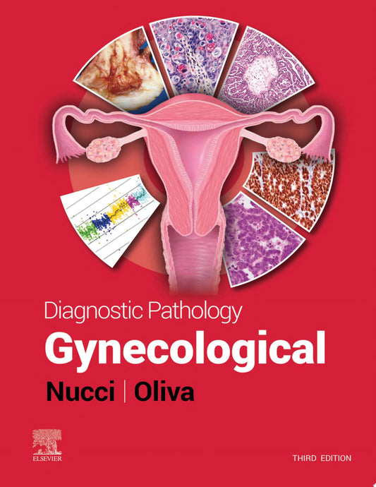 Diagnostic Pathology: Gynecological, 3rd edition