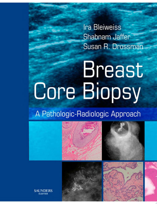 Breast Core Biopsy: A Pathologic-Radiologic Approach