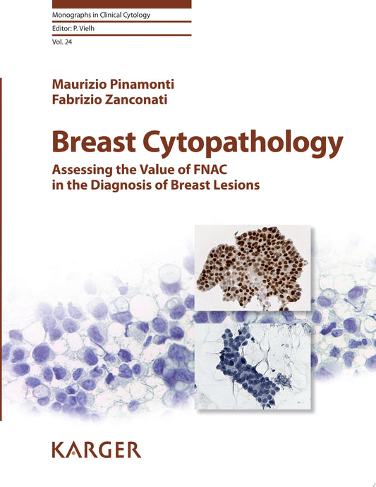 Breast Cytopathology: Assessing the Value of FNAC in the Diagnosis of Breast Lesions